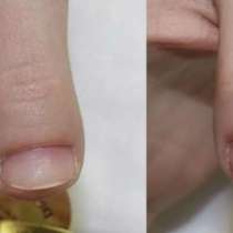 Наращивание ногтей, укрепление, маникюр, в Адлере