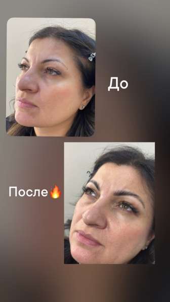 Ламинирование бровей в Одинцово