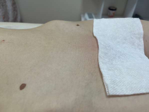 Депиляция шугаринг в Краснодаре