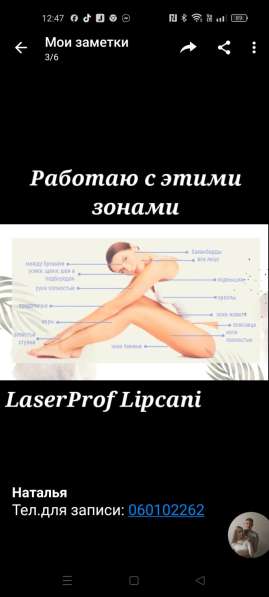 Лазерная эпиляция LaserProf Lipcani в фото 3