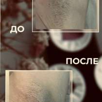 Требуются модели на восковую депиляцию!!!, в Балашихе